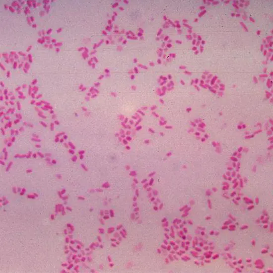 Bacteroides Infection